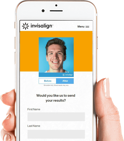invisalign